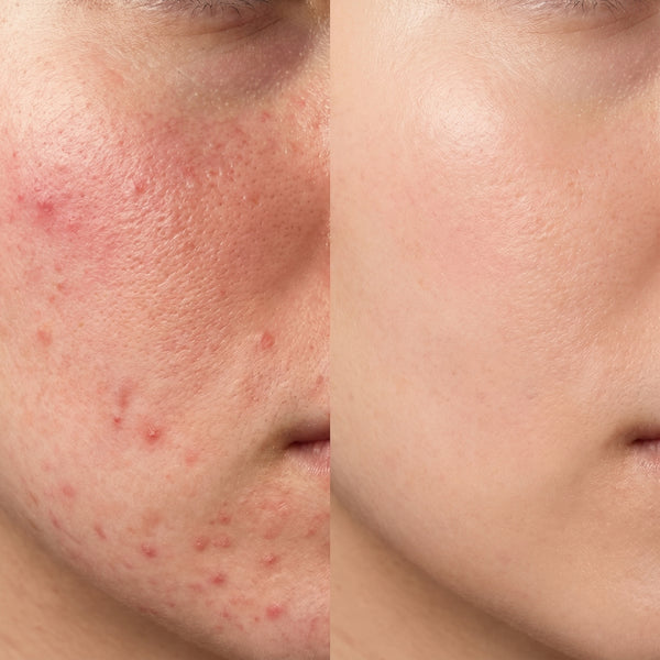 Younger Looking Skin